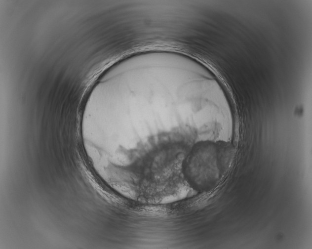 X0000115170437200912091027