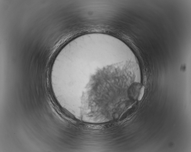 X0000115170443200912091028