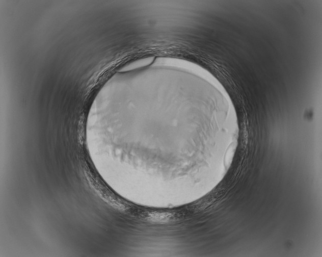 X0000115170450200912091028