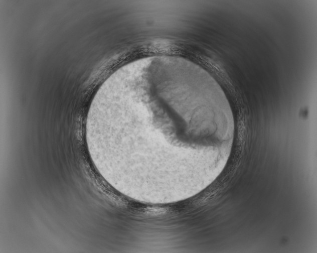 X0000115170457200912091028