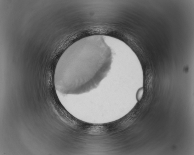 X0000115170459200912091028