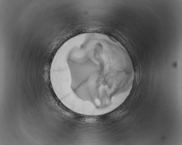 X0000115170462200912091028