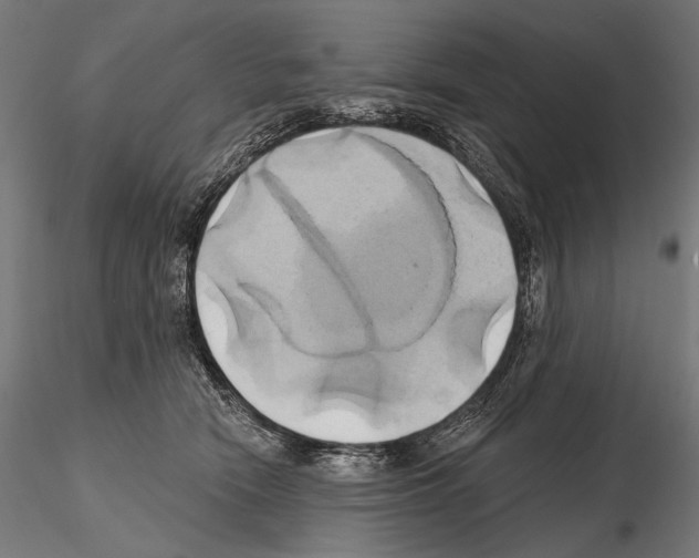 X0000115170466200912091028