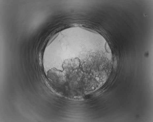 X0000115170477200912091028