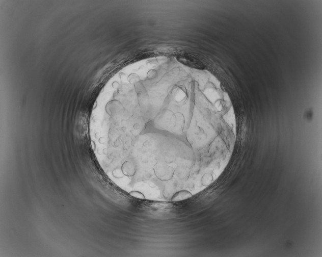 X0000115170478200912091028