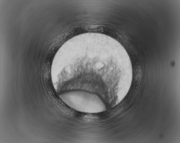 X0000115170515200912091027