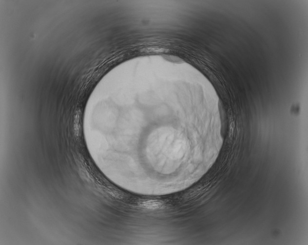 X0000115170551200912091026