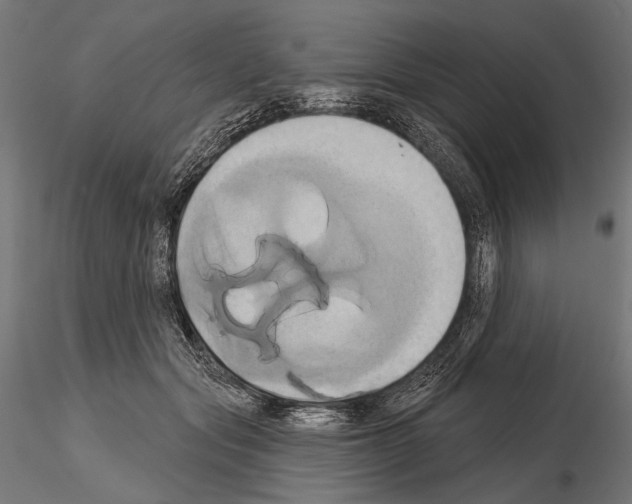 X0000115170557200912091026