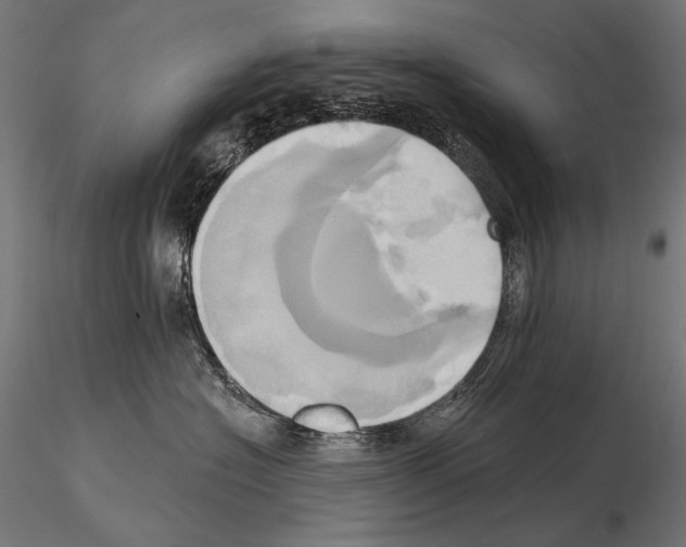 X0000115170574200912091027