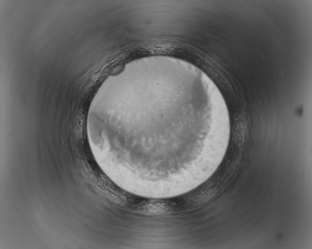 X0000115170604200912091025