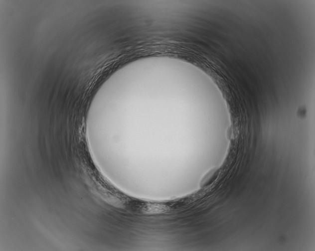 X0000115170605200912091025