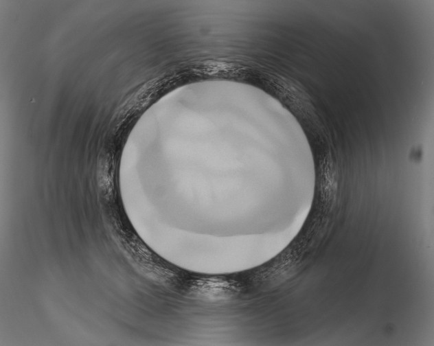 X0000115170607200912091025