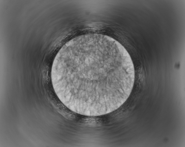 X0000115170615200912091025