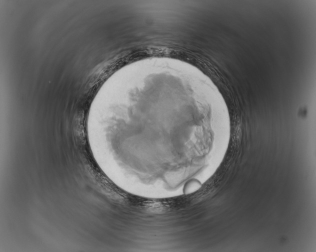 X0000115170616200912091025