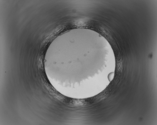 X0000115170618200912091025