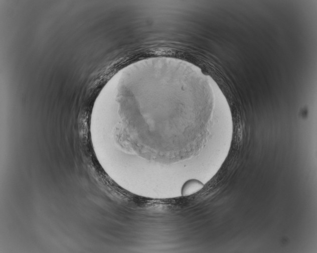 X0000115170620200912091025