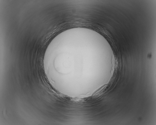 X0000115170621200912091025