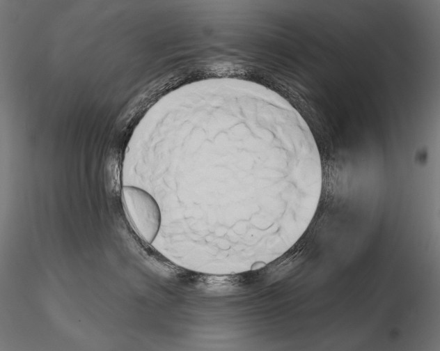 X0000115170622200912091025