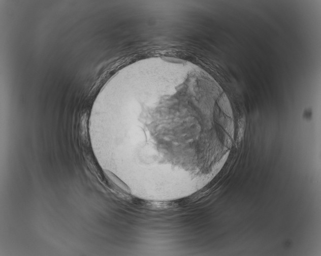 X0000115170623200912091025