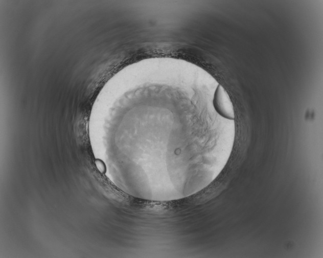 X0000115170624200912091025