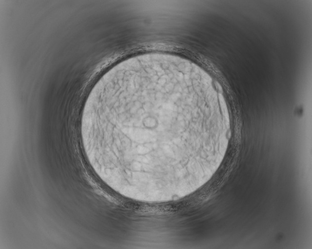 X0000115170625200912091024