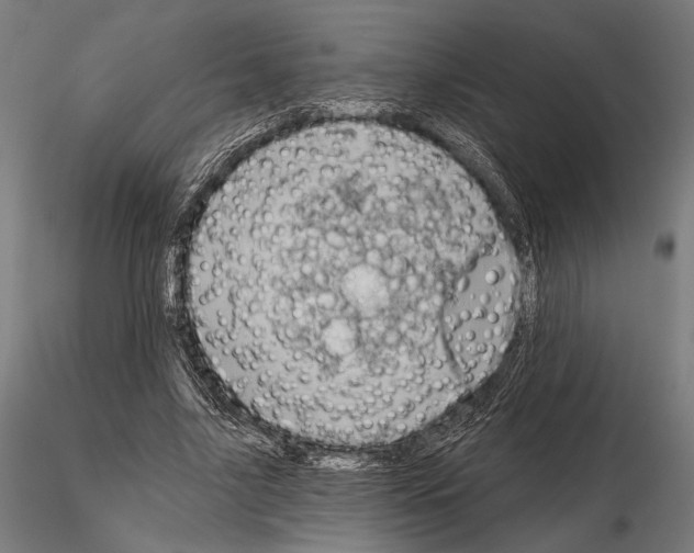 X0000115170635200912091024