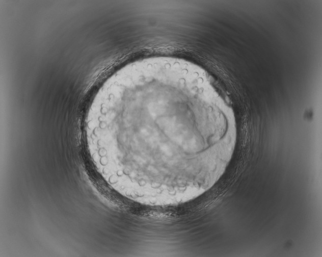 X0000115170638200912091024