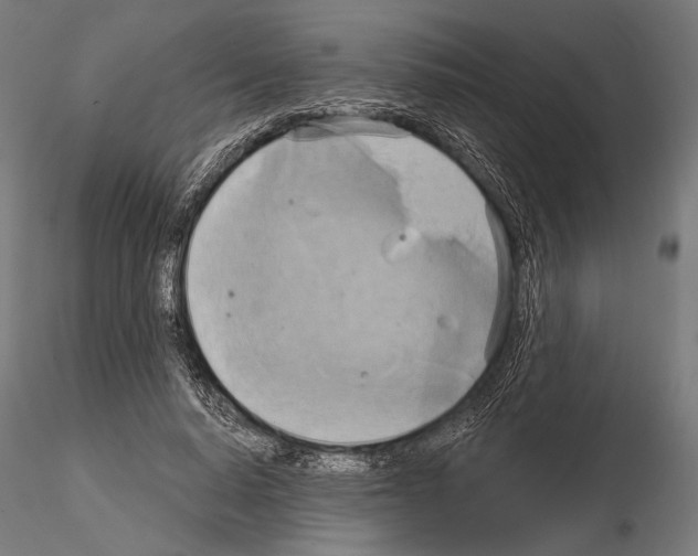 X0000115170640200912091024