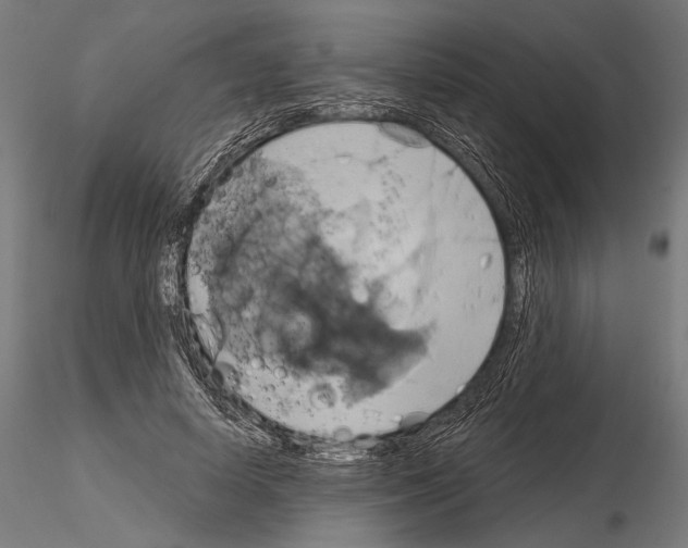 X0000115170642200912091024