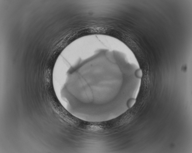 X0000115170649200912091025