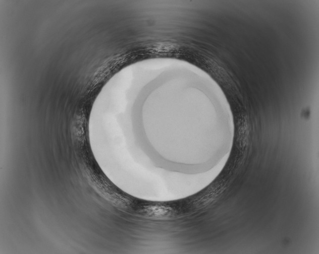 X0000115170654200912091025