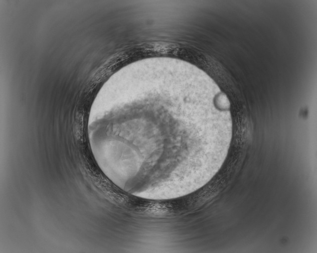 X0000115170656200912091025