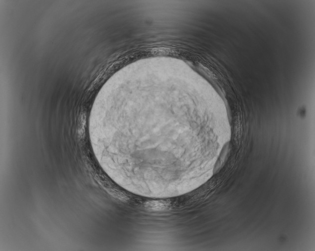 X0000115170660200912091025