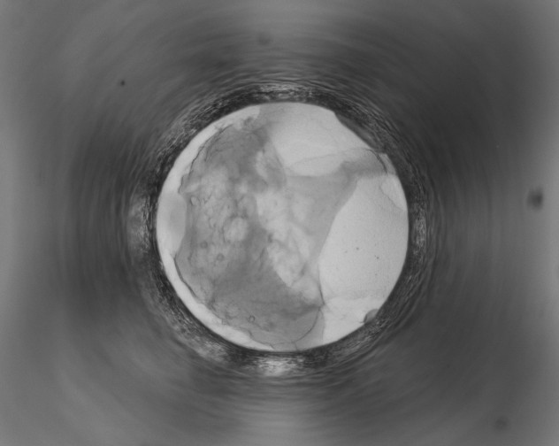 X0000115170662200912091025