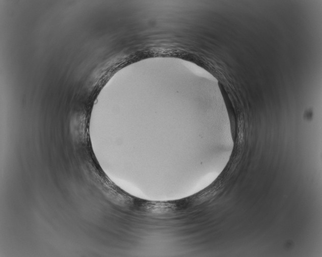 X0000115170670200912091025