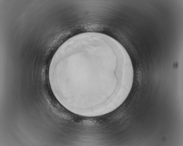 X0000115170690200912091024