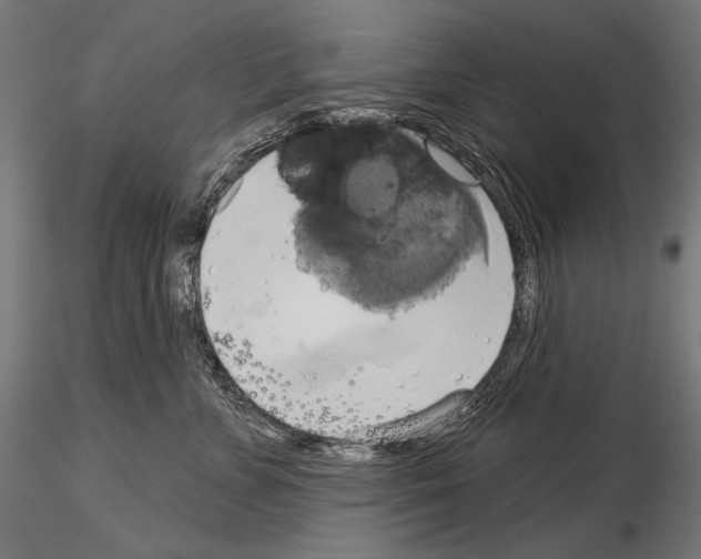 X0000115170715200912091024