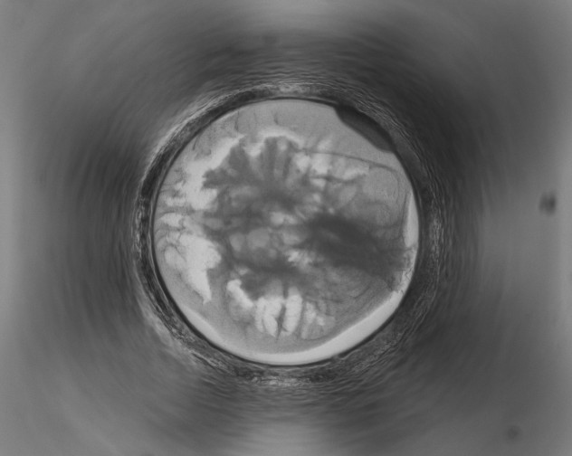 X0000115170730200912091023