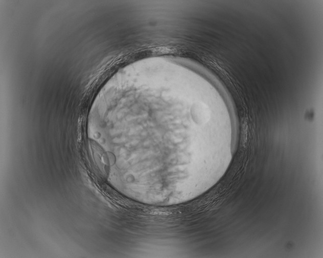 X0000115170738200912091023