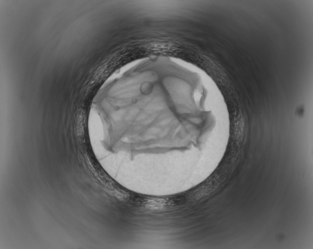 X0000115170757200912091023