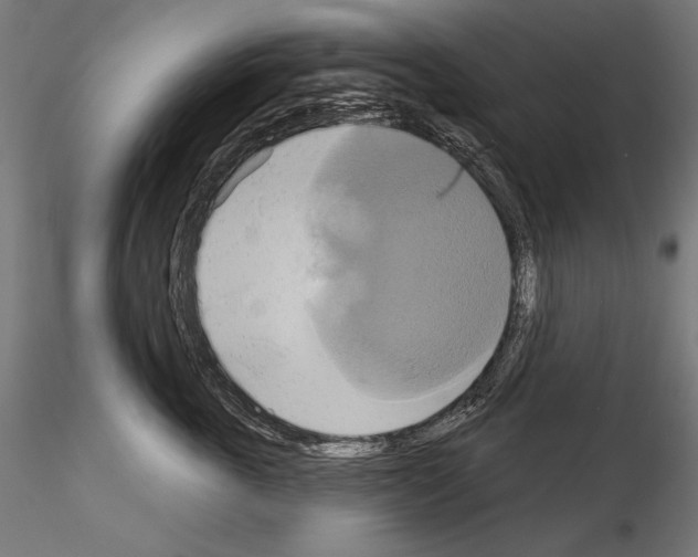 X0000115170763200912091023