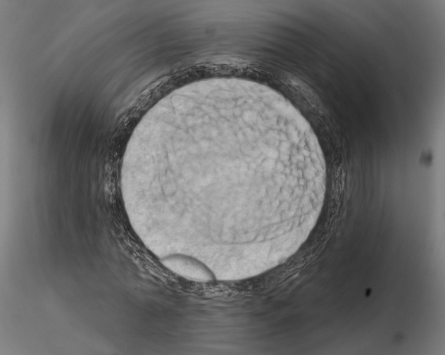 X0000115170774200912091022