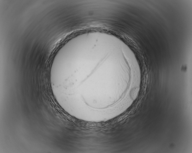 X0000115170776200912091022