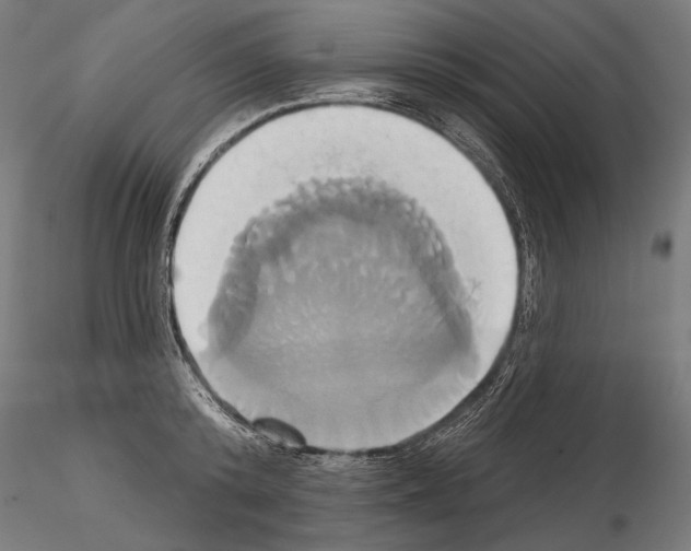 X0000115170800200912091022