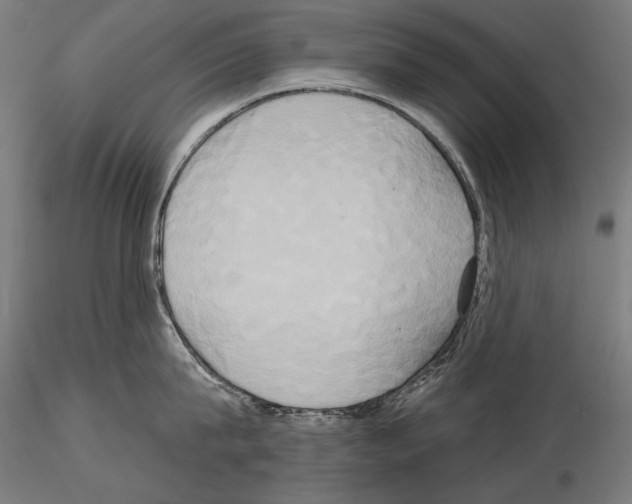 X0000115170815200912091022