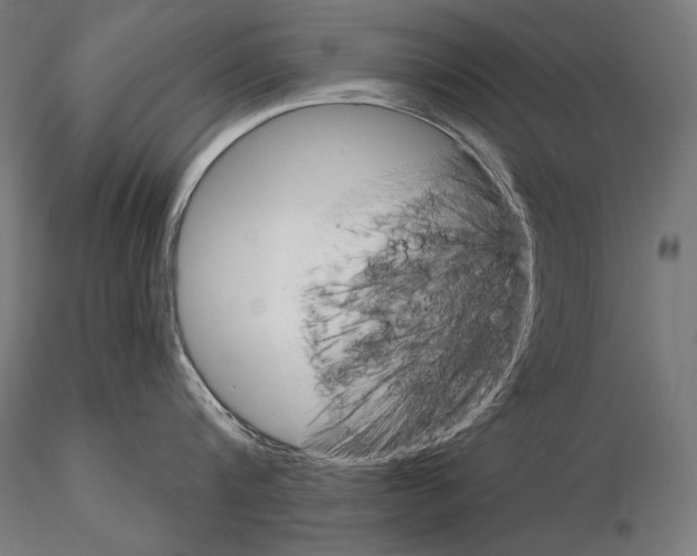 X0000115170816200912091022