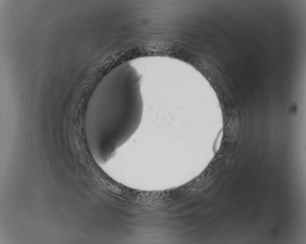 X0000115170817200912091021