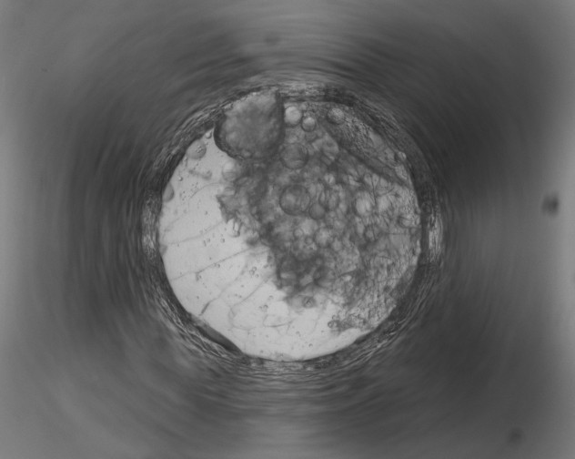 X0000115170819200912091021