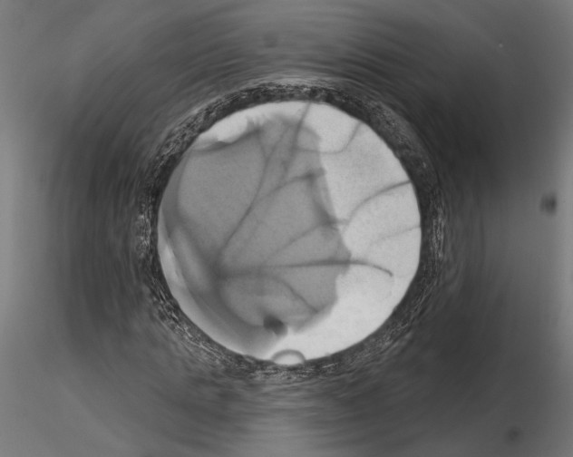 X0000115170821200912091021