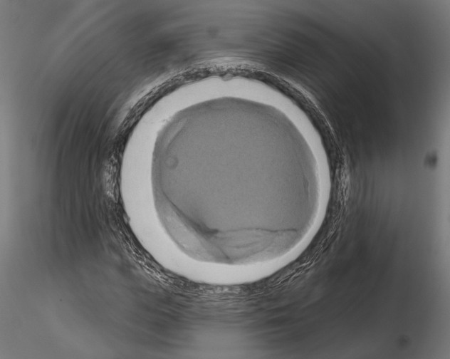 X0000115170823200912091021